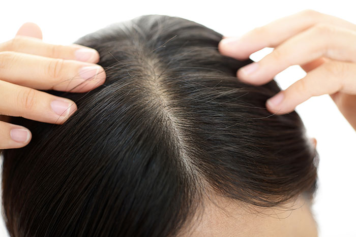 Why should we treat our scalp?